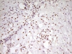 MEF2D Mouse anti-Human, Clone: OTI10B4, lyophilized, TrueMAB 100 &mu;g;