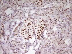MEF2D Mouse anti-Human, Clone: OTI10B4, lyophilized, TrueMAB 100 &mu;g;
