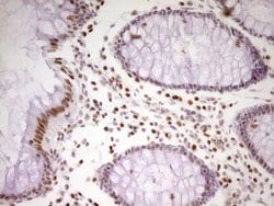 MEF2D Mouse anti-Human, Clone: OTI10B4, lyophilized, TrueMAB 100 &mu;g;