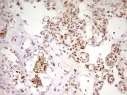 MEF2D Mouse anti-Human, Clone: OTI10B4, lyophilized, TrueMAB 100 &mu;g;