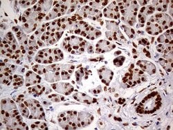 MEIS1 Mouse anti-Human, Clone: OTI2A3, lyophilized, TrueMAB 100 &mu;g;