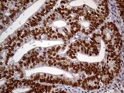 MEIS1 Mouse anti-Human, Clone: OTI2A3, lyophilized, TrueMAB 100 &mu;g;