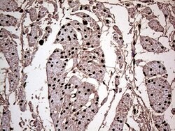 MEIS1 Mouse anti-Human, Clone: OTI1B4, lyophilized, TrueMAB 100 &mu;g;