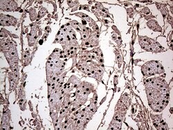 MEIS1 Monoclonal Antibody (OTI1B4), TrueMAB , OriGene 100 &mu;L; Unconjugated:Antibodies,