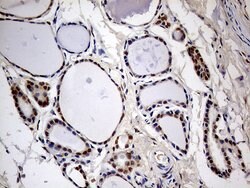 MEIS1 Monoclonal Antibody (OTI3H2), TrueMAB , OriGene 100 &mu;L; Unconjugated:Antibodies,