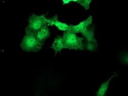 MEIS3 Monoclonal Antibody (OTI2E12), TrueMAB , OriGene 100 &mu;L; Unconjugated:Antibodies,