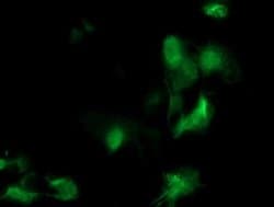 MEIS3 Monoclonal Antibody (OTI3A7), TrueMAB , OriGene 100 &mu;L; Unconjugated:Antibodies,