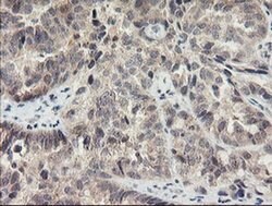 MEIS3 Monoclonal Antibody (OTI2E12), TrueMAB , OriGene 100 &mu;L; Unconjugated:Antibodies,