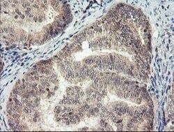 MEIS3 Monoclonal Antibody (OTI2E12), TrueMAB , OriGene 100 &mu;L; Unconjugated:Antibodies,