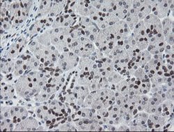MEIS3 Monoclonal Antibody (OTI3C9), TrueMAB , OriGene 100 &mu;L; Unconjugated:Antibodies,