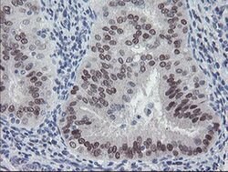 MEIS3 Monoclonal Antibody (OTI3C9), TrueMAB , OriGene 100 &mu;L; Unconjugated:Antibodies,