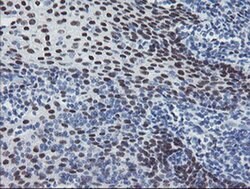 MEIS3 Monoclonal Antibody (OTI3C9), TrueMAB , OriGene 100 &mu;L; Unconjugated:Antibodies,