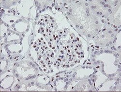 MEIS3 Monoclonal Antibody (OTI3C9), TrueMAB , OriGene:Antibodies:Primary