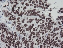 MEIS3 Monoclonal Antibody (OTI3E12), TrueMAB , OriGene 100 &mu;L; Unconjugated:Antibodies,