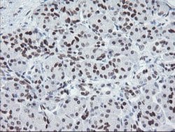 MEIS3 Monoclonal Antibody (OTI3E12), TrueMAB , OriGene:Antibodies:Primary
