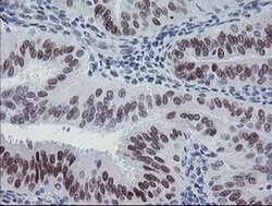 MEIS3 Monoclonal Antibody (OTI3E12), TrueMAB , OriGene 100 &mu;L; Unconjugated:Antibodies,