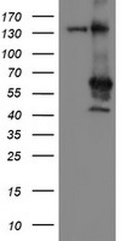 MEIS3 Monoclonal Antibody (OTI2E12), TrueMAB , OriGene 100 &mu;L; Unconjugated:Antibodies,
