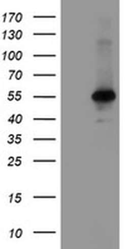 MEIS3 Monoclonal Antibody (OTI1E4), TrueMAB , OriGene 100 &mu;L; Unconjugated:Antibodies,