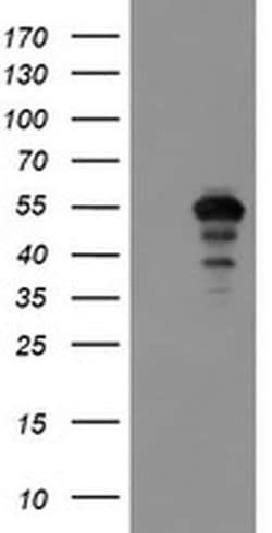 MEIS3 Monoclonal Antibody (OTI2F4), TrueMAB , OriGene:Antibodies:Primary