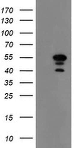 MEIS3 Monoclonal Antibody (OTI2F1), TrueMAB , OriGene 100 &mu;L; Unconjugated:Antibodies,