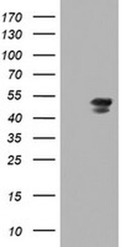 MEIS3 Monoclonal Antibody (OTI3C9), TrueMAB , OriGene 100 &mu;L; Unconjugated:Antibodies,