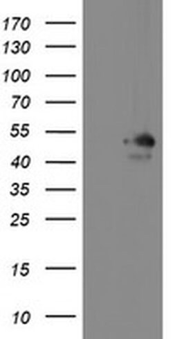 MEIS3 Monoclonal Antibody (OTI3E12), TrueMAB , OriGene 100 &mu;L; Unconjugated:Antibodies,