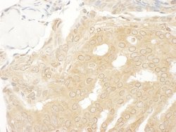 MEK2 Polyclonal Antibody, Bethyl Laboratories 10 &mu;L | Buy Online | Bethyl Laboratories, Inc | Fisher Scientific