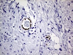 MEOX1 Monoclonal Antibody (OTI5D8), TrueMAB , OriGene 100 &mu;L; Unconjugated:Antibodies,