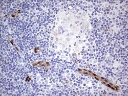 MEOX1 Monoclonal Antibody (OTI5B11), TrueMAB , OriGene:Antibodies:Primary