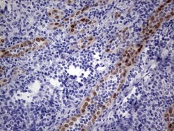 MEOX1 Monoclonal Antibody (OTI5B11), TrueMAB , OriGene:Antibodies:Primary