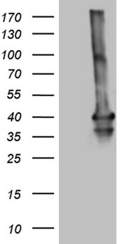 MEOX1 Monoclonal Antibody (OTI5D8), TrueMAB , OriGene 100 &mu;L; Unconjugated:Antibodies,