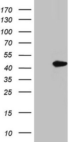 MEOX1 Monoclonal Antibody (OTI2A6), TrueMAB , OriGene:Antibodies:Primary