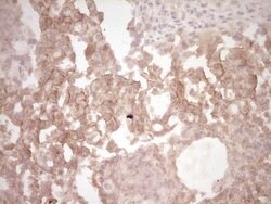 MET Monoclonal Antibody (OTI3G5), TrueMAB , OriGene:Antibodies:Primary