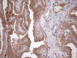 MET Mouse anti-Human, Clone: UMAB190, liquid, UltraMAB 100 &mu;L; Unconjugated:Antibodies,