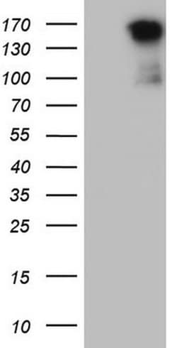 MET Monoclonal Antibody (OTI18A5), TrueMAB , OriGene 100 &mu;L; Unconjugated:Antibodies,