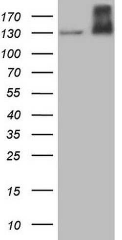 MET Mouse anti-Human, Clone: OTI1E6, lyophilized, TrueMAB 100 &mu;g; Unconjugated:Antibodies,