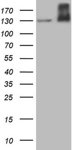 MET Monoclonal Antibody (OTI1E6), TrueMAB , OriGene:Antibodies:Primary