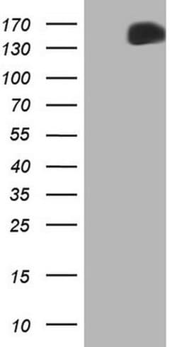 MET Monoclonal Antibody (OTI3G5), TrueMAB , OriGene 100 &mu;L; Unconjugated:Antibodies,