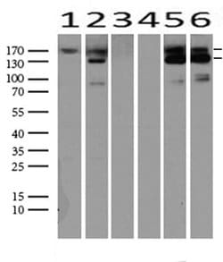 MET Mouse anti-Human, Clone: UMAB190, liquid, UltraMAB 100 &mu;L; Unconjugated:Antibodies,