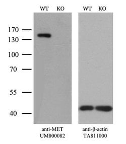 MET Mouse anti-Human, Clone: UMAB190, liquid, UltraMAB 100 &mu;L; Unconjugated:Antibodies,