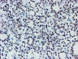 METT10D Mouse anti-Human, Clone: OTI3B5, lyophilized, TrueMAB 100 &mu;g;