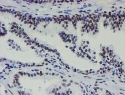 METT10D Mouse anti-Human, Clone: OTI3B5, lyophilized, TrueMAB 100 &mu;g;
