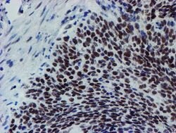 METT10D Mouse anti-Human, Clone: OTI3B5, lyophilized, TrueMAB 100 &mu;g;