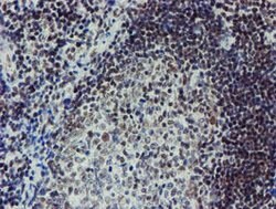 METT10D Mouse anti-Human, Clone: OTI3B5, lyophilized, TrueMAB 100 &mu;g;