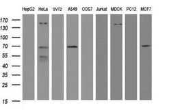 METT10D Mouse anti-Human, Clone: OTI3E8, lyophilized, TrueMAB 100 &mu;g;