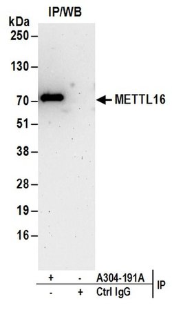 METTL16 Rabbit anti-Human, Polyclonal, Bethyl Laboratories 10 &mu;l; Unlabeled:Antibodies,