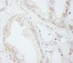 METTL3/MT-A70 Rabbit anti-Human, Polyclonal, Bethyl Laboratories 100 &mu;l;