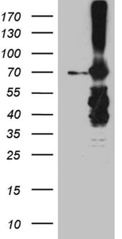 METTL3 Mouse anti-Human, Mouse, Rat, Clone: OTI1B7, lyophilized, TrueMAB