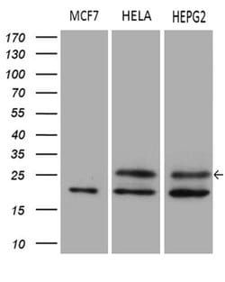 METTL7A Mouse anti-Human, Clone: OTI4B10, liquid, TrueMAB 100 &mu;L | Buy Online | Origene Technologies | Fisher Scientific