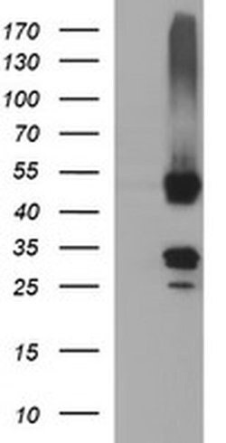 MFAP3 Monoclonal Antibody (OTI1B3), TrueMAB , OriGene:Antibodies:Primary
